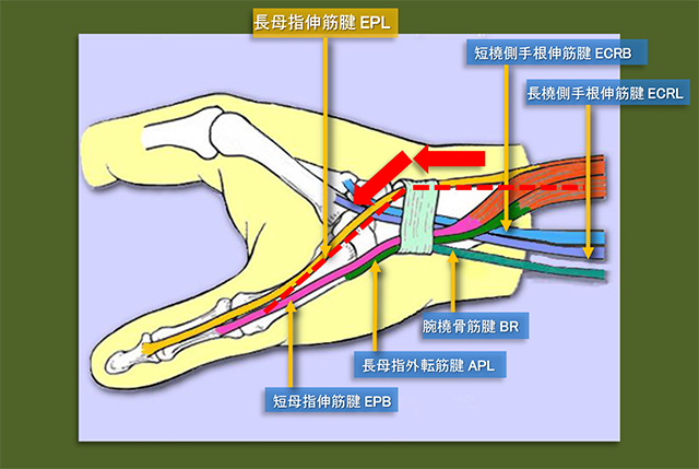 図　手関節橈側での長母指伸筋腱の走行