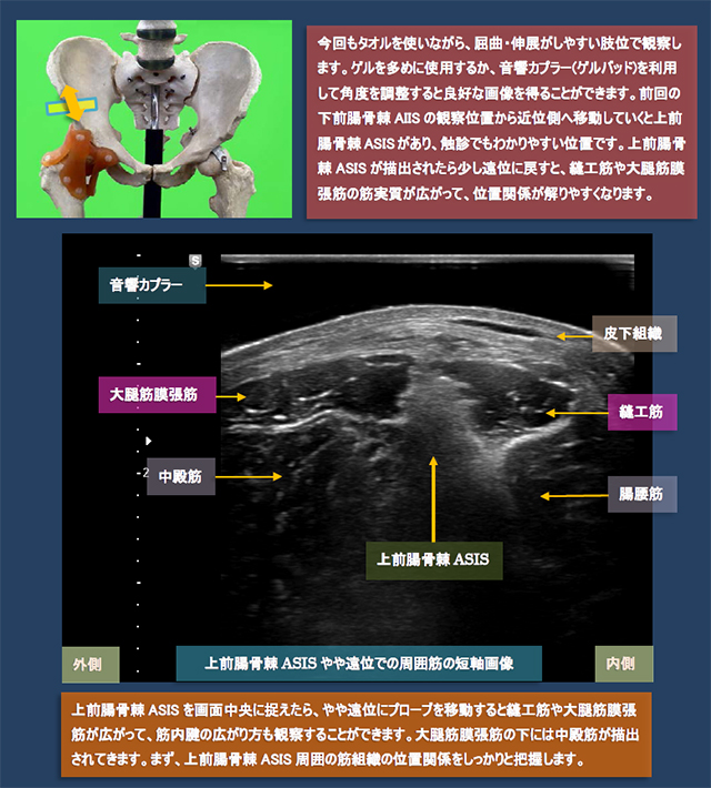 股関節前方の超音波観察法　上前腸骨棘AIIS周辺筋の短軸画像