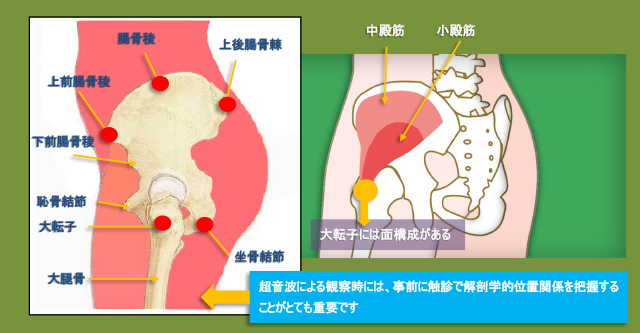 股関節外側の解剖と触診位置