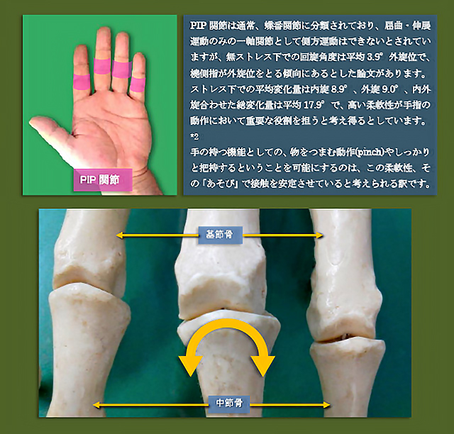 図 PIP関節 関節面の形状